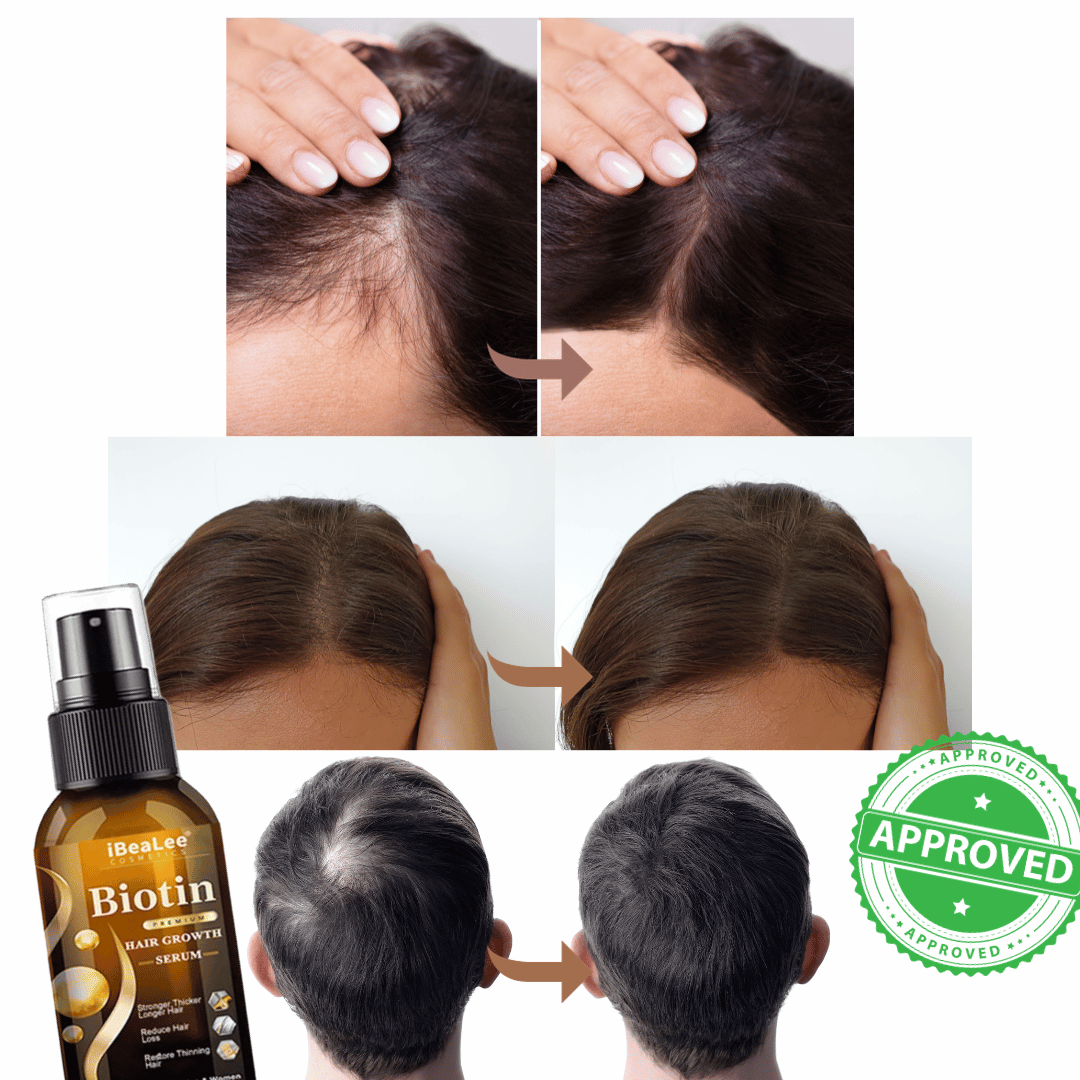Biotina Crescimento Capilar - DeLuxe Hair - Tratamento para Cabelos Unissex